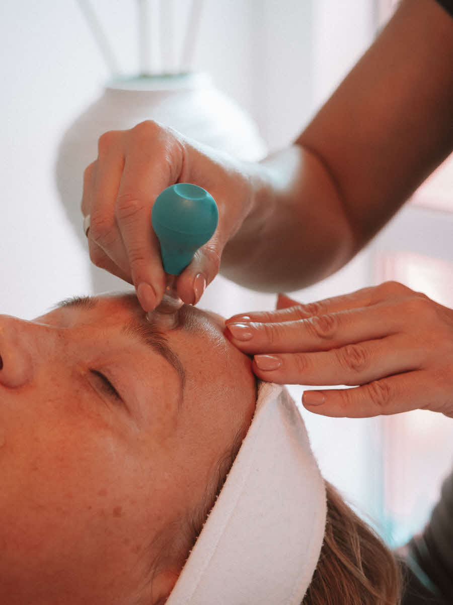Facial cupping gezichtsbehandeling voor een natuurlijke glow bij The Cupping Hands